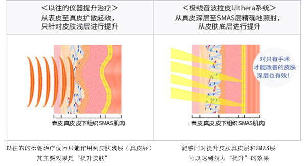 施术时间约为40分钟