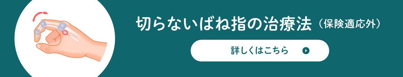 切らないばね指の治療法（保険適応外）詳しくはこちら