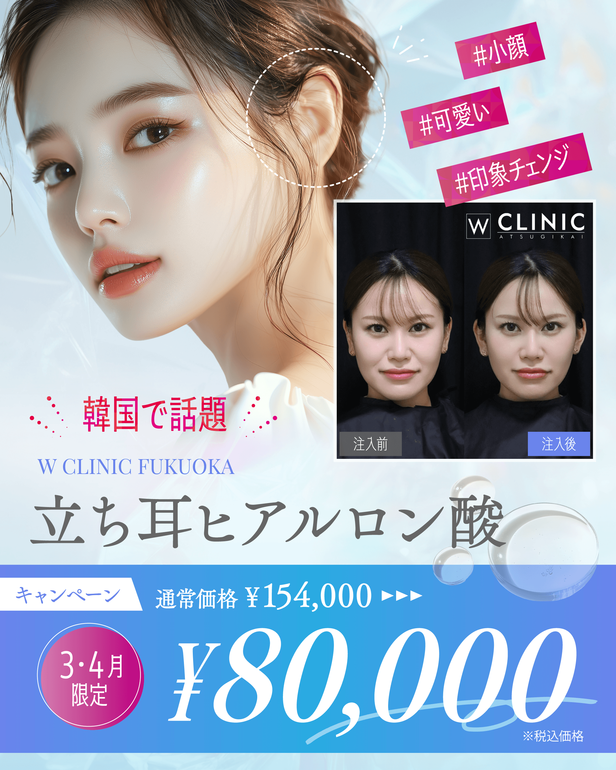 たち耳ヒアルロン酸