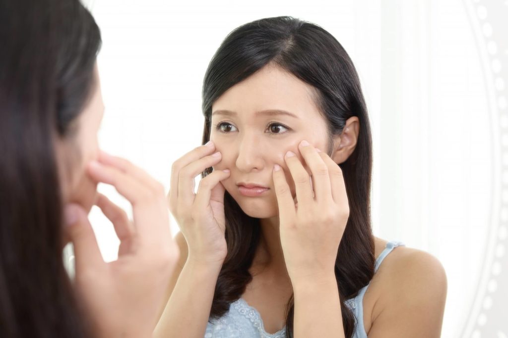 シミ取りレーザー後のダウンタイムについて