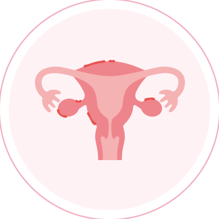 子宮内膜症