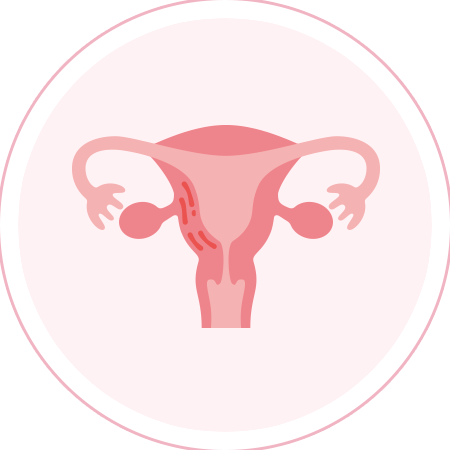 子宮腺筋症