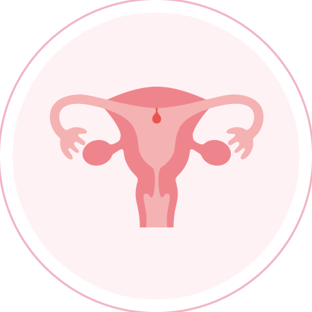 子宮内膜ポリープ