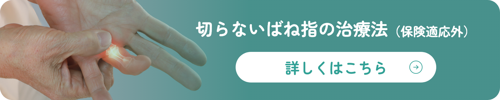 切らないばね指の治療法