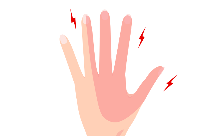 手根管症候群とは