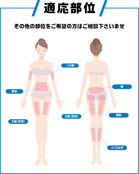 適応部位 二の腕 腹部 太もも 腰 臀部 ふくらはぎ