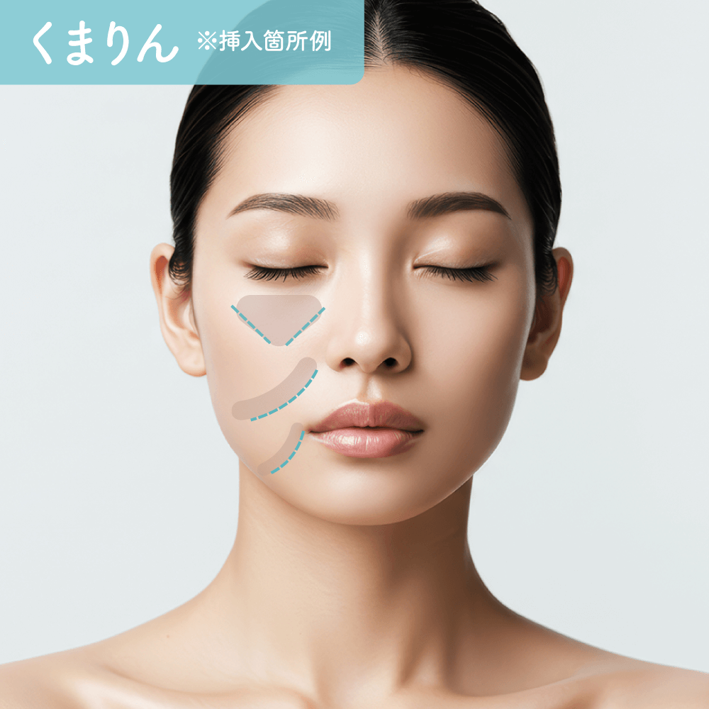 くまりん挿入箇所例