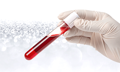 ACRS療法（自己血サイトカインリッチ血清）