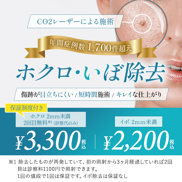 年間症例数1,700件超え ホクロ・いぼ除去 傷跡が目立ちにくい・短時間施術・キレイな仕上がり CO2レーザー