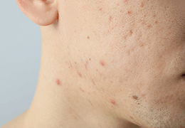 男性患者様も安心して受けられます