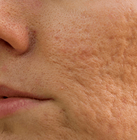 結果が出にくい難治性の治療、深い悩みも終わりにしましょう