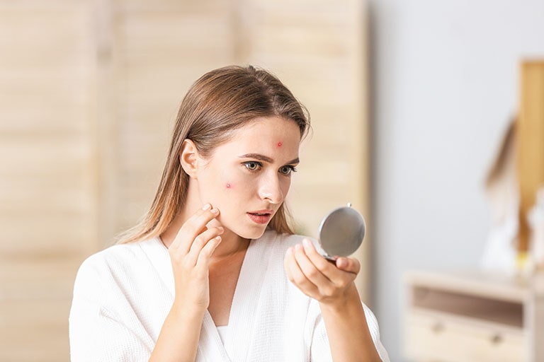 美容皮膚科で最適なニキビ治療を！効果が高いおすすめの治療法をご紹介