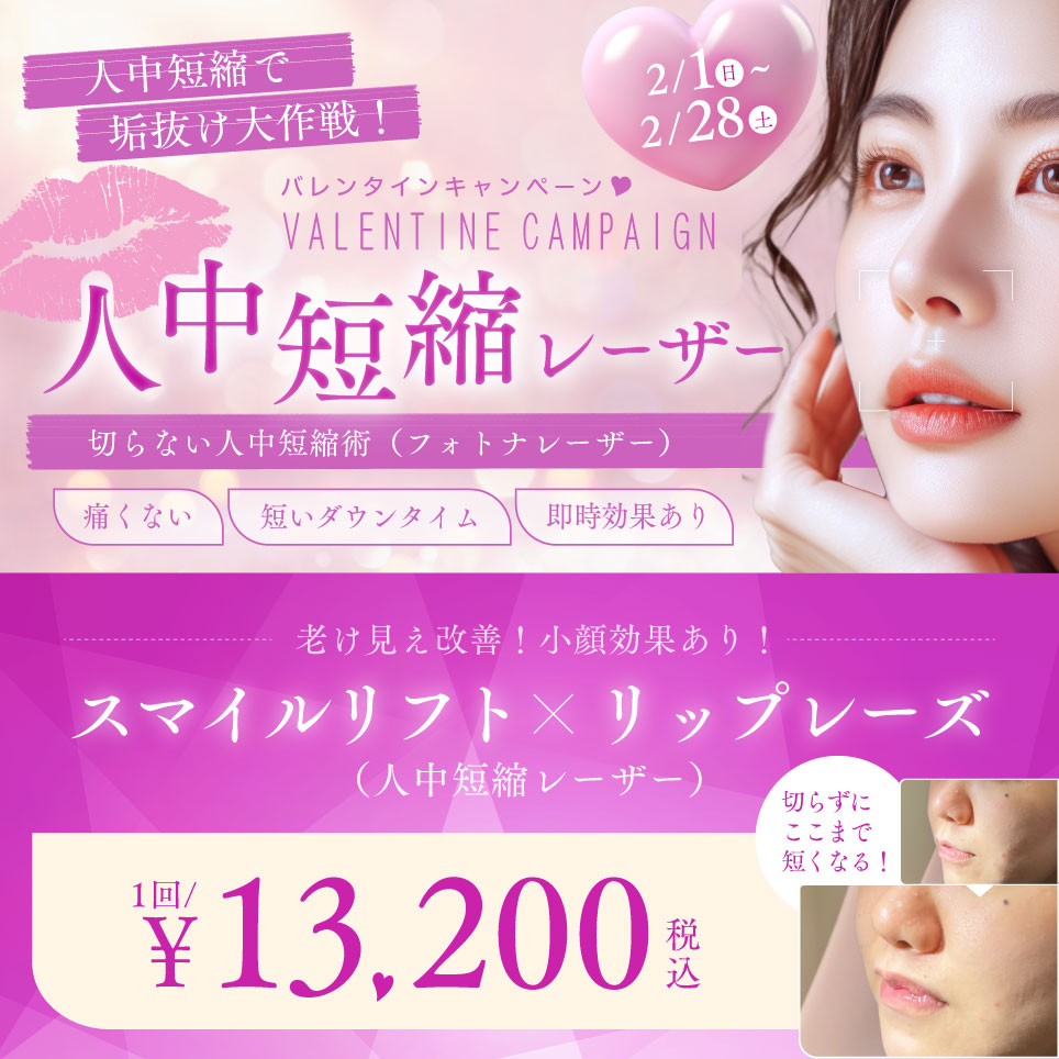 バレンタインキャンペーン（人中短縮レーザー）